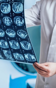 مراجعة صور MRI/CT، تقرير مكتوب